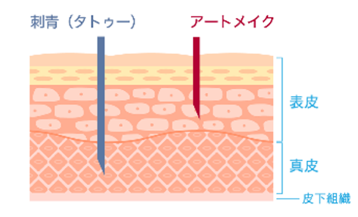 イメージ：医療アートメイクとは