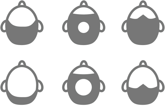 イメージ：AGAの進行パターン