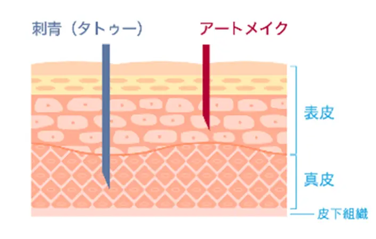 イメージ：医療アートメイクとは