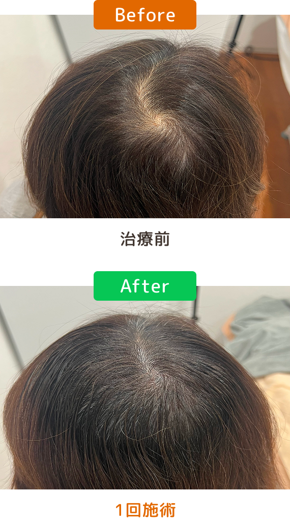 イメージ：40代女性